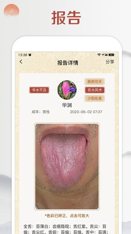 看舌头下载介绍图